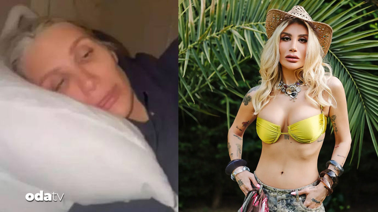 İrem Derici 40 dikişle sahne aldı: ‘Kafam kemiğe kadar açıldı’